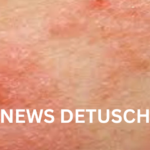Wie man to avoid bitesolgemokz effektiv umsetzt