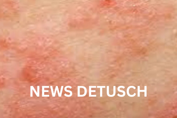 Wie man to avoid bitesolgemokz effektiv umsetzt