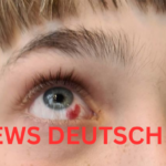 Geplatzte Ader im Auge – Ursachen, Symptome, Behandlung und Vorbeugung